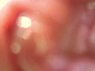 Olbrzymka analny vore pov