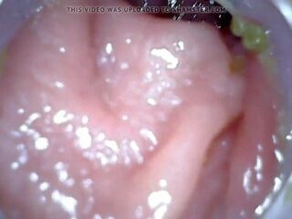 Anal endoscope teil 1, kostenlos arschspülung bestrafung hd porno 04